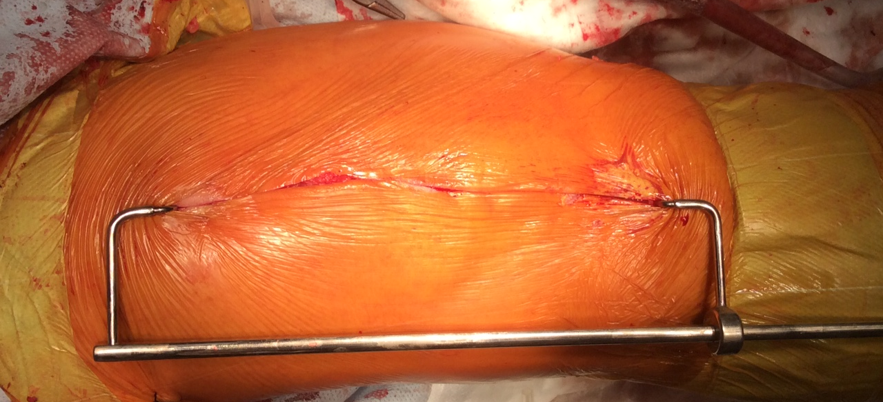 Застосування блоку вирівнювання розрізу