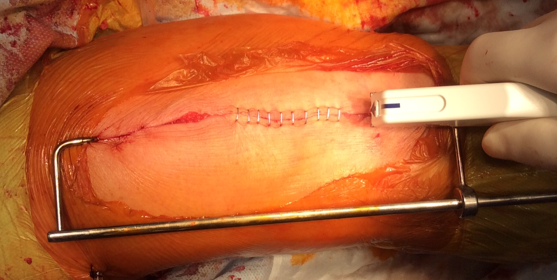 Застосування блоку вирівнювання розрізу