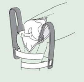 застосування елеватора Hohmann для колінного суглоба