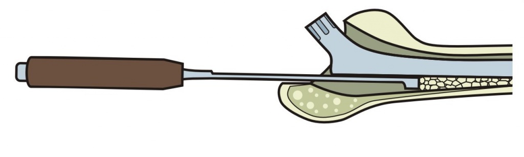 Застосування імпактора з вибіркою половини окружності R4