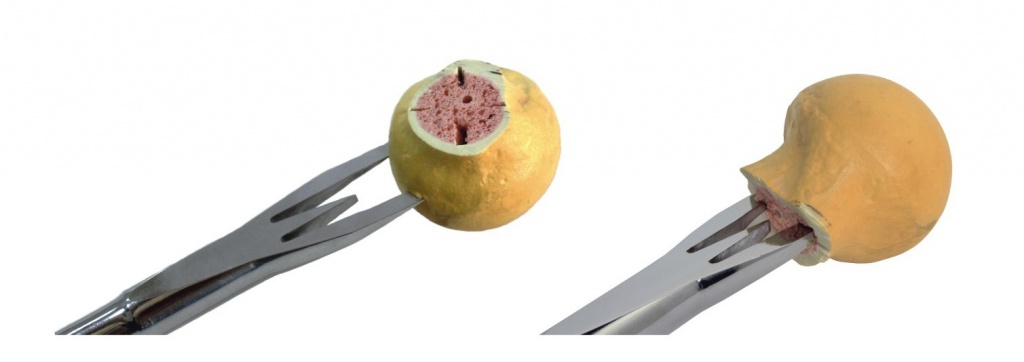 Вилковий екстрактор для головки стегна