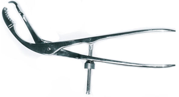 Костотримач за AO з гвинтовим фіксатором