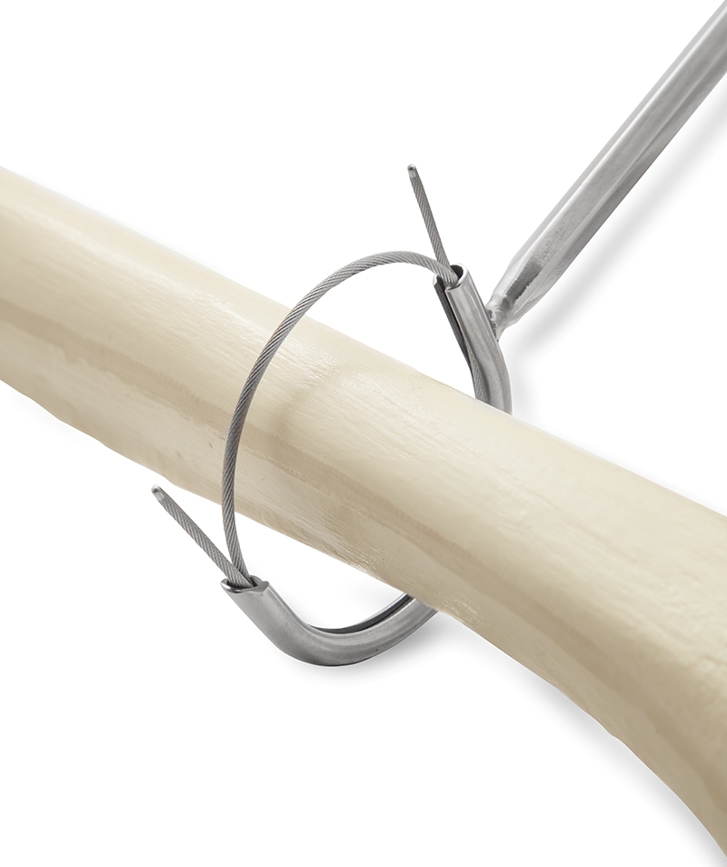 Застосування гачка-направника для серкляжу в протезуванні