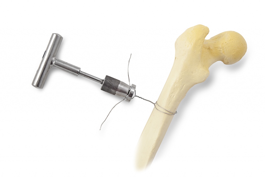 Застосування натягувача для серкляжного дроту