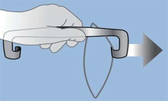 Використання ретрактора «Тягни-штовхай»